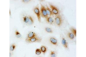 ICC testing of HSP70 antibody and A549 cells