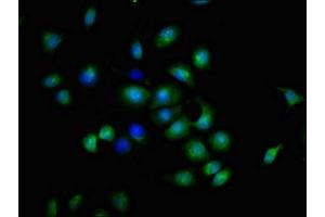 Immunofluorescent analysis of A549 cells using ABIN7173895 at dilution of 1:100 and Alexa Fluor 488-congugated AffiniPure Goat Anti-Rabbit IgG(H+L) (CD137 anticorps  (AA 24-186))