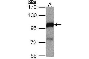 WB Image Sample(30 μg of whole cell lysate) A:MOLT4, 7. (DLC1 anticorps  (N-Term))