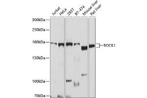 Western blot analysis of extracts of various cell lines, using ROCK1 antibody  at 1:1000 dilution.