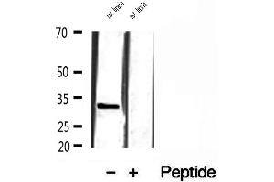 Western blot analysis of extracts of rat brain tissue, using SULT4A1 antibody.