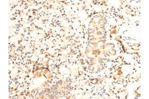 ABIN6267072 at 1/100 staining mouse lung tissue sections by IHC-P. (JAK1 anticorps  (pTyr1022, pTyr1023))