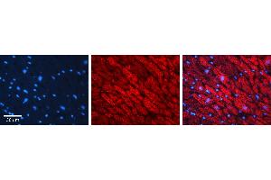 Rabbit Anti-CALR Antibody Catalog Number: ARP58123_P050 Formalin Fixed Paraffin Embedded Tissue: Human heart Tissue Observed Staining: Plasma membrane in intercalated disk Primary Antibody Concentration: 1:100 Other Working Concentrations: 1:600 Secondary Antibody: Donkey anti-Rabbit-Cy3 Secondary Antibody Concentration: 1:200 Magnification: 20X Exposure Time: 0.