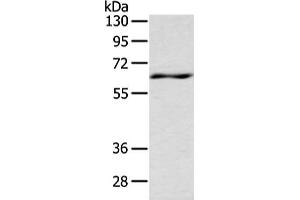 Gel: 8 % SDS-PAGE, Lysate: 80 μg, Lane: Mouse spleen tissue, Primary antibody: ABIN7191331(LZTS1 Antibody) at dilution 1/200 dilution, Secondary antibody: Goat anti rabbit IgG at 1/8000 dilution, Exposure time: 10 seconds (LZTS1 anticorps)