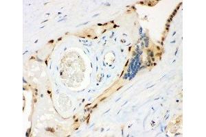 IHC-P: MSK1 antibody testing of human placenta tissue (MSK1 anticorps  (AA 540-665))