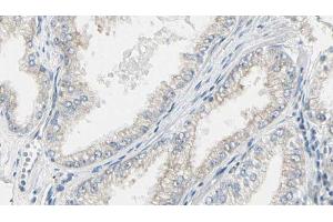 ABIN6267468 at 1/100 staining Human prostate tissue by IHC-P. (CDC25B anticorps  (pSer353))