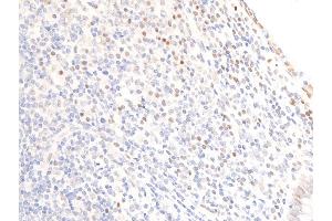 ABIN6256098 and ABIN6267269 at 1/100 staining human appendiceal tissue sections by IHC-P. (EGFR anticorps  (pSer1071))