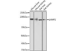 Western blot analysis of extracts of various cell lines, using L Rabbit mAb  at 1:1000 dilution. (LAMP2 anticorps)