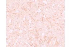 Immunohistochemical staining of human brain cells with NLRP12 polyclonal antibody  at 5 ug/mL. (NLRP12 anticorps  (N-Term))