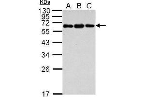 WB Image Sample (30 ug of whole cell lysate) A: Jurkat B: Raji C: K562 12% SDS PAGE antibody diluted at 1:1000 (C4BPB anticorps)