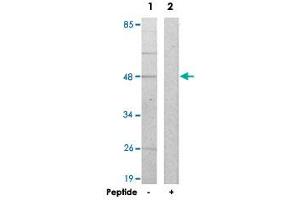 Western blot analysis of extracts from HepG2 cells, using AZI2 polyclonal antibody . (AZI2 anticorps  (N-Term))