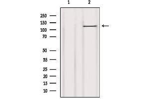Western blot analysis of extracts from B16F10, using CBL Antibody. (CBL anticorps  (Internal Region))