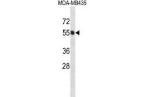 Western blot analysis in MDA-MB435 cell line lysates (35ug/lane) using PIGA  Antibody . (PIGA anticorps  (C-Term))