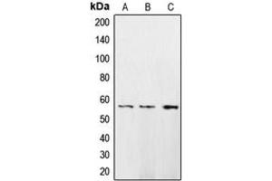 Western blot analysis of CaMK2 delta expression in HeLa (A), A431 (B), H1299 (C) whole cell lysates. (CAMK2D anticorps  (Center))