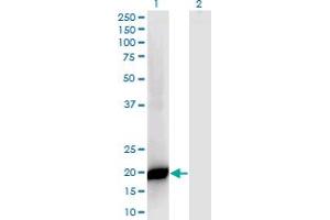 Western Blot analysis of PPP1R14B expression in transfected 293T cell line by PPP1R14B monoclonal antibody (M07), clone 4G2.