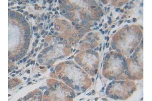 DAB staining on IHC-P; Samples: Human Stomach Tissue (IL20RB anticorps  (AA 37-290))