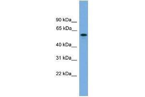 WB Suggested Anti-KIAA1609 Antibody Titration: 0. (KIAA1609 anticorps  (Middle Region))