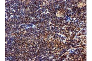 Image no. 6 for anti-EPM2A (Laforin) Interacting Protein 1 (EPM2AIP1) antibody (ABIN1498045) (EPM2AIP1 anticorps)