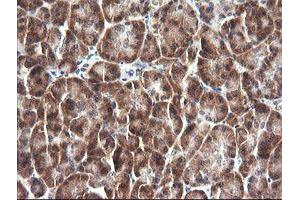 Image no. 2 for anti-Interleukin 1 Family Member 9 (IL1F9) antibody (ABIN1498873)