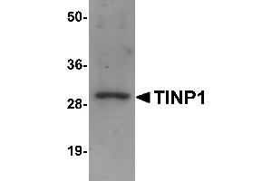 Western Blotting (WB) image for anti-NSA2 Ribosome Biogenesis Homolog (NSA2) (C-Term) antibody (ABIN1030737) (NSA2 anticorps  (C-Term))