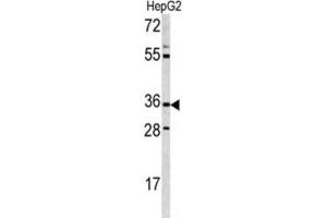 Western Blotting (WB) image for anti-CD38 antibody (ABIN3001687) (CD38 anticorps)