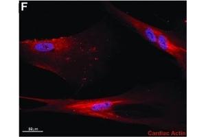Characterization of cardiac differentiation potential of CDCs and CMSCLC.