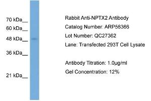 WB Suggested Anti-NPTX2  Antibody Titration: 0. (NPTX2 anticorps  (Middle Region))