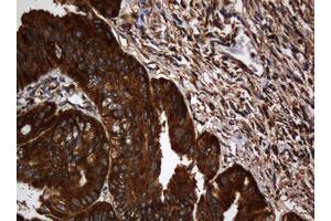 Image no. 4 for anti-SERPINE1 mRNA Binding Protein 1 (SERBP1) (AA 1-262) antibody (ABIN1490674)