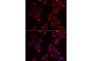 Immunofluorescence analysis of U2OS cells using NCR1 antibody (ABIN5973838). (NCR1 anticorps)
