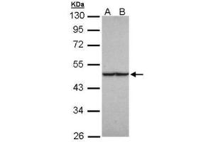 WB Image Sample (30 ug of whole cell lysate) A: HeLa B: Hep G2 , 10% SDS PAGE antibody diluted at 1:1000 (FH anticorps)