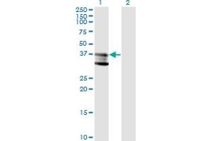Western Blot analysis of SMPD1 expression in transfected 293T cell line by SMPD1 monoclonal antibody (M01), clone 4H2. (SMPD1 anticorps  (AA 1-364))