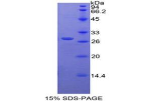SDS-PAGE analysis of Rat RARa Protein.