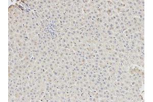 Immunohistochemistry (IHC) image for anti-DEAD (Asp-Glu-Ala-Asp) Box Polypeptide 5 (DDX5) antibody (ABIN1876484) (DDX5 anticorps)