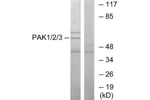 Western blot analysis of extracts from NIH-3T3 cells, using PAK1/2/3 (epitope around residue 423/402/421) antibody.