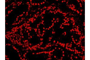 Immunofluorescence (IF) image for anti-cAMP Responsive Element Binding Protein 1 (CREB1) (AA 250-300) antibody (ABIN7448947)