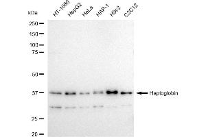 Western blotting analysis using Haptoglobin antibody (ABIN7798837).