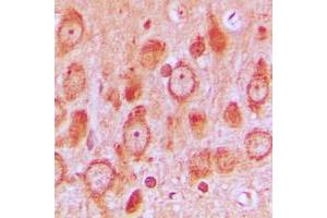 Immunohistochemical analysis of c-SRC (pS75) staining in human brain formalin fixed paraffin embedded tissue section.
