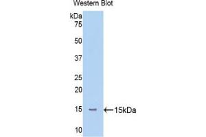 Western blot analysis of the recombinant protein. (Mannose Associated Serine Protease 2 (AA 170-287) anticorps)