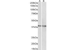 ABIN768559 (1µg/ml) staining of Rat (A) and Pig (B) Heart lysate (35µg protein in RIPA buffer). (IDH3G anticorps  (AA 337-350))