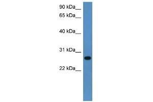 WB Suggested Anti-Cyb5r2 Antibody Titration: 0. (CYB5R2 anticorps  (C-Term))