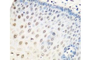 Immunohistochemistry of paraffin-embedded Human esophagus using HNRNPA0 Polyclonal Antibody at dilution of 1:100 (40x lens). (HNRNPA0 anticorps)