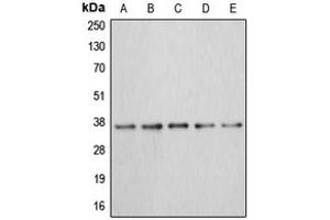 Western blot analysis of Annexin A3 expression in MCF7 (A), HEK293T (B), HepG2 (C), mouse kidney (D), rat liver (E) whole cell lysates.