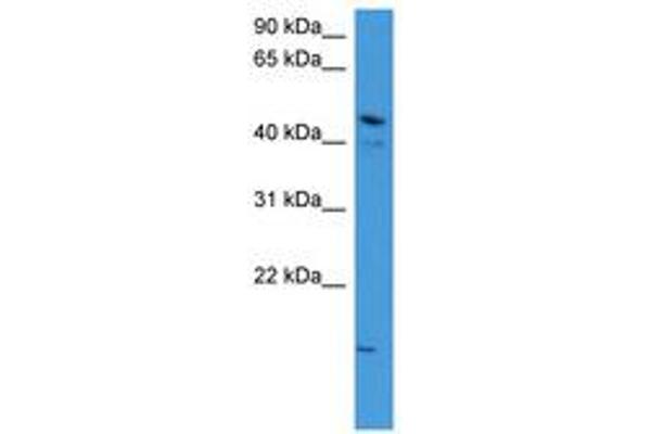 ZNF713 anticorps  (AA 63-112)