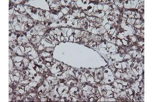 Image no. 10 for anti-SKI-Like Oncogene (SKIL) (AA 307-684) antibody (ABIN1491380)