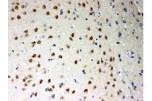 Anti- PKC iota Picoband antibody, IHC(P): Mouse Brain Tissue
