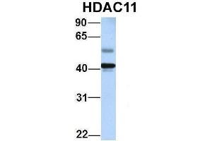 Host:  Rabbit  Target Name:  HDAC11  Sample Type:  Human Adult Placenta  Antibody Dilution:  1. (HDAC11 anticorps  (Middle Region))
