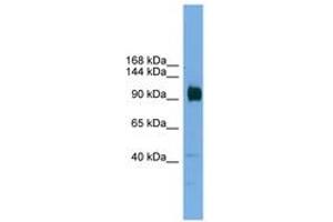 Image no. 1 for anti-Zinc Finger Protein 445 (ZNF445) (AA 601-650) antibody (ABIN6744636) (ZNF445 anticorps  (AA 601-650))