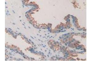 IHC-P analysis of Human Prostate Gland Tissue, with DAB staining. (TOR1A anticorps  (AA 33-321))