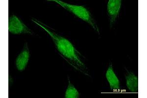 Immunofluorescence of monoclonal antibody to CTDP1 on HeLa cell.