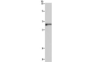 Western Blotting (WB) image for anti-Elastin (ELN) antibody (ABIN5543469) (Elastin anticorps)